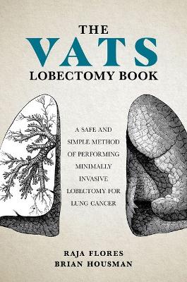 VATS Lobectomy Book: A Safe and Simple Method of Performing Minimally Invasive Lobectomy for Lung Cancer