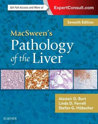 MacSween's Pathology of the Liver 7th edition