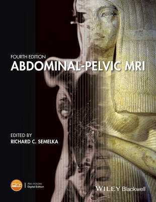 Abdominal-Pelvic MRI 4th edition