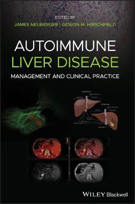 Autoimmune Liver Disease - Management and Clinical  Practice: Management and Clinical Practice