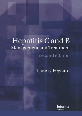 Hepatitis B and C: Management and Treatment