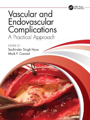 Vascular and Endovascular Complications: A Practical Approach: A Practical Approach