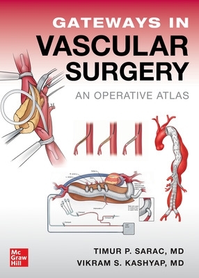 Gateways in Vascular Surgery: An Operative Atlas: An Operative Atlas
