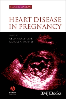 Heart Disease in Pregnancy 2nd edition