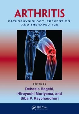 Arthritis: Pathophysiology, Prevention, and Therapeutics