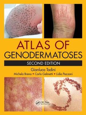 Atlas of Genodermatoses 2nd edition