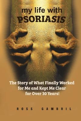 my life with PSORIASIS: The story of what finally worked for me and kept me clear for over 30 years!
