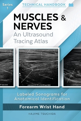Muscles & Nerves - Technical Ultrasound Handbook: An Ultrasound Tracing Atlas (Series 1)
