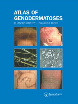 Atlas of Genodermatoses