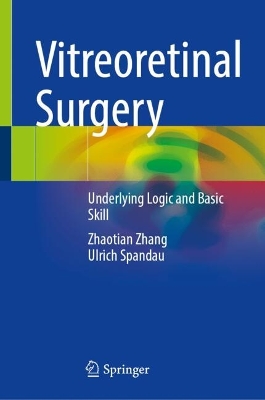 Vitreoretinal Surgery: Underlying Logic and Basic Skill