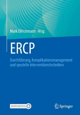ERCP: Durchf&uuml;hrung, Komplikationsmanagement und spezielle Interventionstechniken&nbsp;