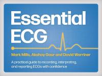Essential ECG: A practical guide to recording, interpreting, and reporting ECGs with  confidence